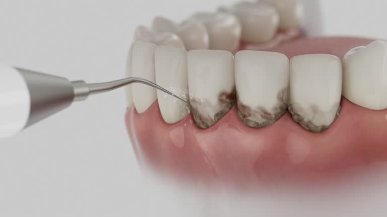 Reliable Dental Implants contractor in Peotone, IL by Smile Center Dentistry